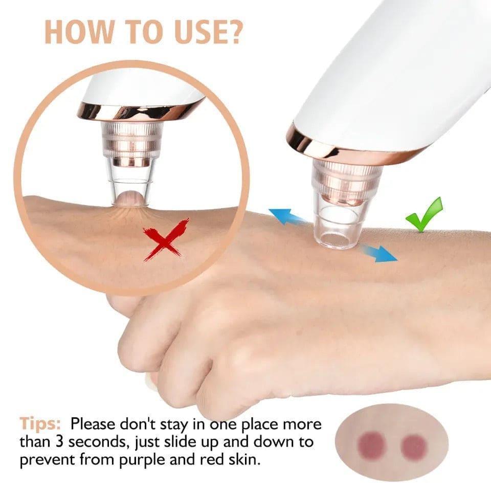 Blackhead Remover for Clear Skin